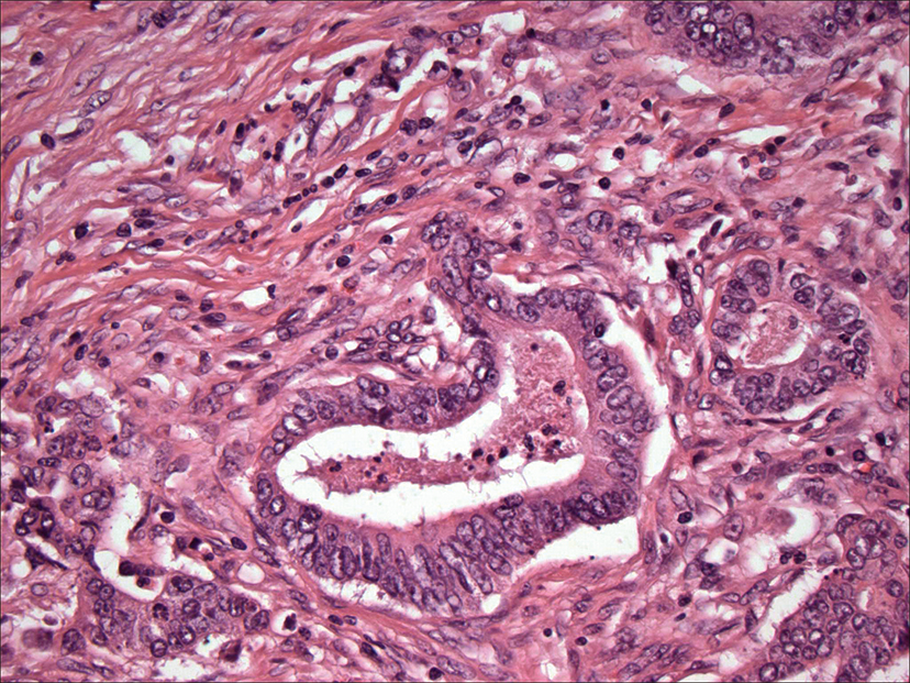 PF_PF_bud-crc-400x3_sm